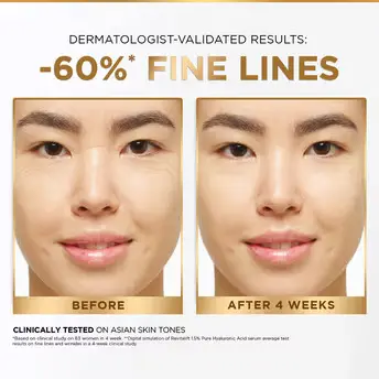 LOreal Paris Revitalift SerumReplumps Skin in 1H, -3.webp